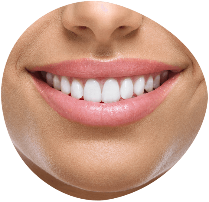 <span class="bt_bb_before_after_image_after_text">Dopo</span>