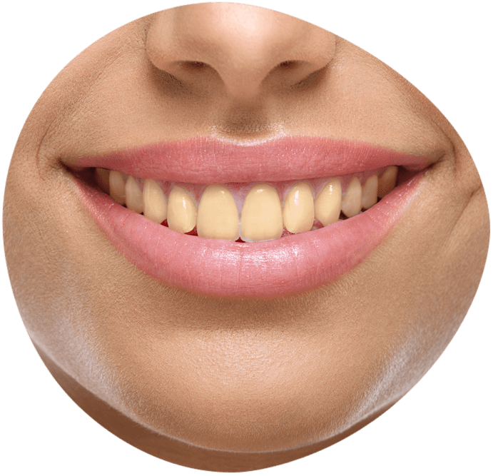 <span class="bt_bb_before_after_image_before_text">Prima</span>