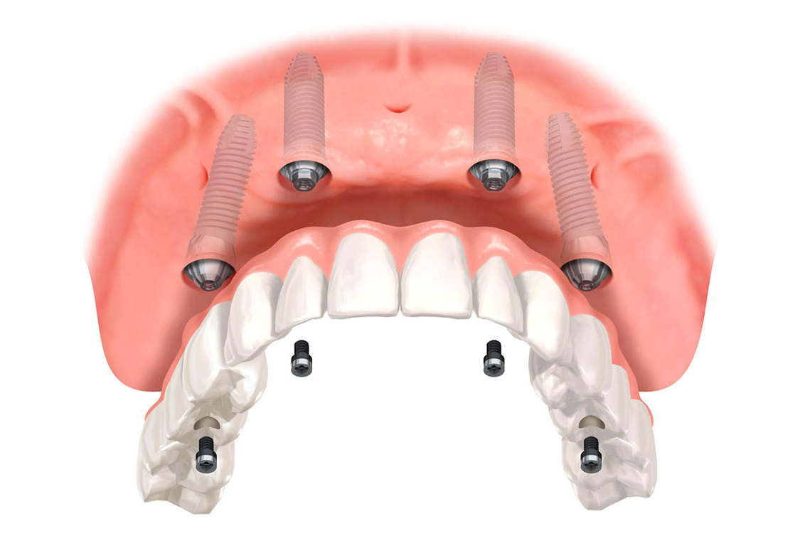 nasal